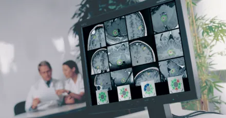 Elekta Stark orderbok att luta sig emot