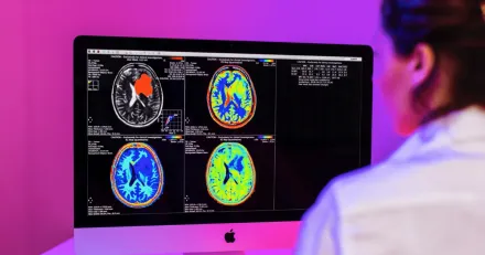 SyntheticMR Skapar klarhet