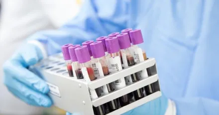 Boule Diagnostics Svaghet drar ut p tiden