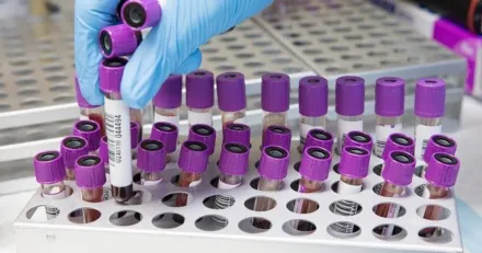 Teknisk kopsignal i Biovica