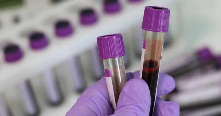 Positiva signaler i Bioinvent