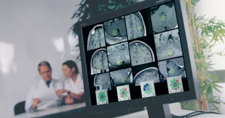 Market Buzz Elekta och Nibe