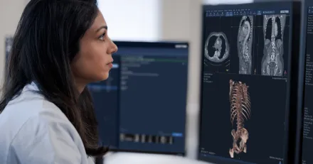 Fortsatt uppsida i Sectra Bevaka denna utbrottsniva