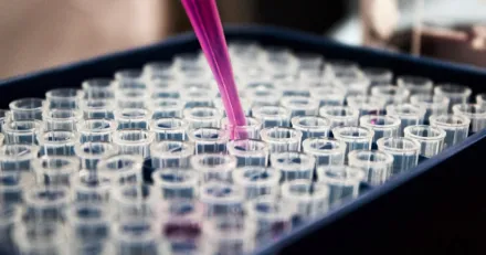 Small Cap Immunovia presenterar banbrytande resultat