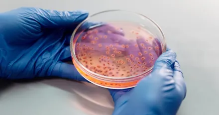 Spannande lage i Hansa Biopharma