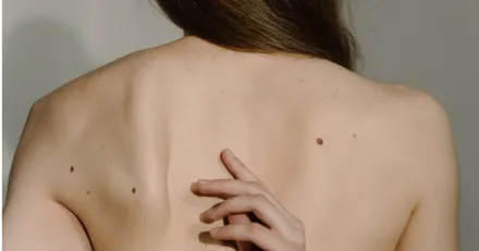 Small Cap SciBase expanderar ytterligare i USA High Quality