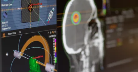 Market Buzz Hexagon och Raysearch High Quality