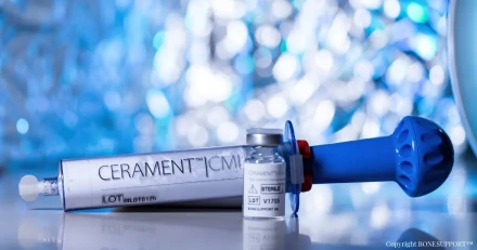 Spnnande lge i Bonesupport High Quality