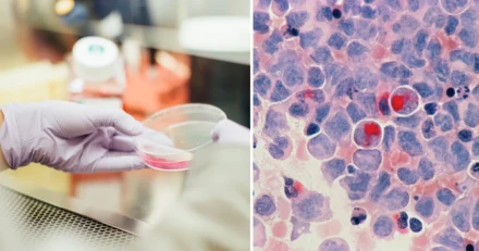 CellaVision Sakta men sakert framat